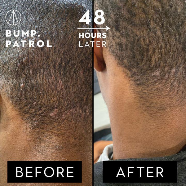 Bump Patrol Aftershave Treatment - Sensitive - Image 2